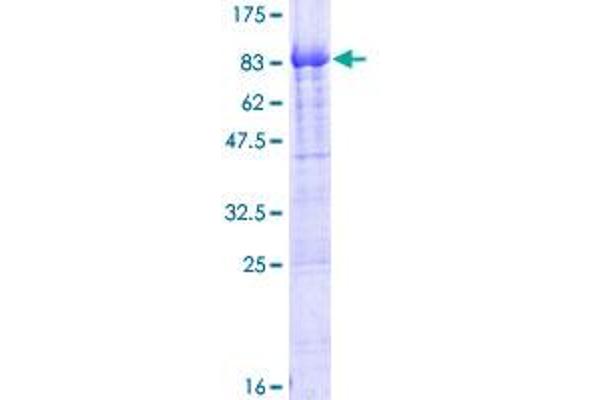 PIKFYVE Protein (AA 1-451) (GST tag)