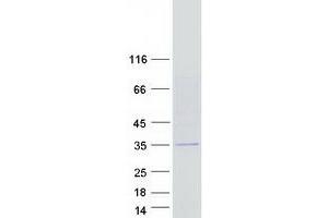 CMT1A Duplicated Region Transcript 15 (CDRT15) protein (Myc-DYKDDDDK Tag)