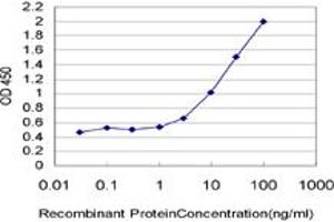 Detection limit for recombinant GST tagged IL22RA1 is approximately 1ng/ml as a capture antibody. (IL22 Receptor alpha 1 antibody  (AA 19-574))
