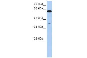 Karyopherin Alpha 6 antibody used at 1 ug/ml to detect target protein.