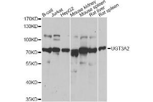Western blot analysis of extracts of various cell lines, using UGT3A2 antibody (ABIN2560665) at 1:1000 dilution. (UGT3A2 antibody)