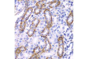 Immunohistochemistry of paraffin-embedded rat kidney using ARRB1 antibody at dilution of 1:100 (400x lens). (beta Arrestin 1 antibody)