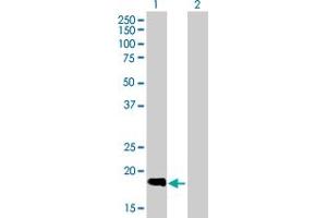 Western Blot analysis of SLC11A1 expression in transfected 293T cell line by SLC11A1 MaxPab polyclonal antibody. (SLC11A1 antibody  (AA 1-178))