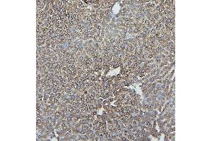 IHC analysis of IFNAR2 using anti-IFNAR2 antibody (ABIN7601353). (IFNAR2 antibody  (AA 33-466))