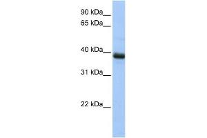 WB Suggested Anti-SPO11 Antibody Titration: 0. (SPO11 antibody  (N-Term))