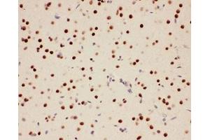 IHC-P: PIAS1 antibody testing of rat brain tissue (PIAS1 antibody  (AA 636-651))