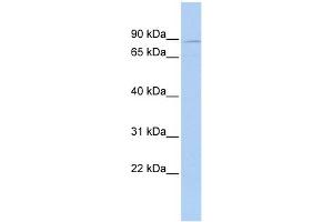 WB Suggested Anti-MEFV Antibody Titration:  0. (MEFV antibody  (N-Term))