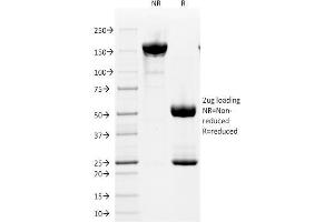 SDS-PAGE Analysis Purified CD2 Mouse Monoclonal Antibody (HuLy-m1). (CD2 antibody)