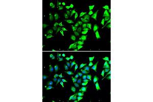 Immunofluorescence analysis of A549 cells using FKBP8 antibody (ABIN5974260).
