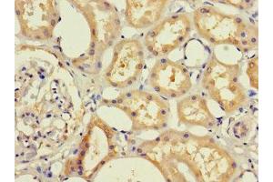 Immunohistochemistry of paraffin-embedded human kidney tissue using ABIN7145636 at dilution of 1:100 (RHD antibody  (AA 32-76))
