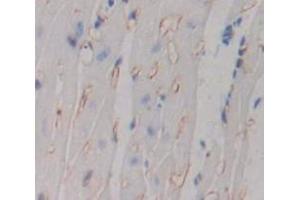 Immunohistochemistry (IHC) image for anti-Tumor Necrosis Factor Receptor Superfamily, Member 10b (TNFRSF10B) (AA 233-367) antibody (ABIN1173677)