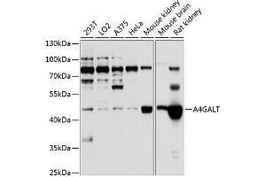 Western blot analysis of extracts of various cell lines, using GALT antibody (ABIN6131973, ABIN6136304, ABIN6136305 and ABIN6224802) at 1:1000 dilution. (A4GALT antibody  (AA 244-353))