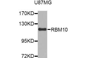 Western blot analysis of extracts of U87MG cell line, using RBM10 antibody. (RBM10 antibody  (AA 1-180))