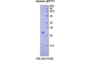 SDS-PAGE analysis of Human LEFTY1 Protein. (LEFTY1 Protein)
