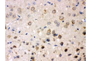 IHC testing of FFPE mouse brain with FE65 antibody.