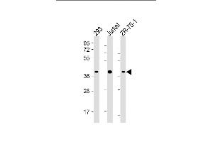 All lanes : Anti-HIF1AN Antibody (C-term) at 1:4000 dilution Lane 1: 293 whole cell lysate Lane 2: Jurkat whole cell lysate Lane 3: ZR-75-1 whole cell lysate Lysates/proteins at 20 μg per lane. (HIF1AN antibody  (AA 1-349))