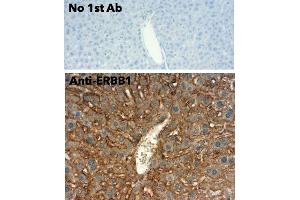 Immunohistochemistry (IHC) image for anti-Epidermal Growth Factor Receptor (EGFR) (C-Term) antibody (ABIN6254171)