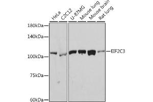 Western blot analysis of extracts of various cell lines, using eIF2C3 Rabbit mAb (ABIN7267039) at 1:1000 dilution. (EIF2C3 antibody)