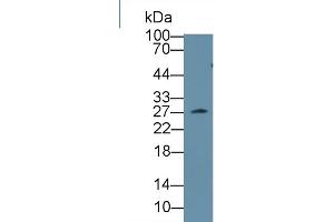 Western Blot; Sample: Mouse Serum; Primary Ab: 1µg/ml Rabbit Anti-Mouse CLTA Antibody Second Ab: 0.