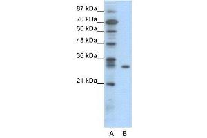 WB Suggested Anti-NFKBIB  Antibody Titration: 0.