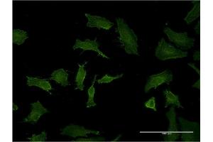 Immunofluorescence of monoclonal antibody to BID on HeLa cell. (BID antibody  (AA 1-195))