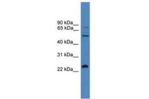 Image no. 1 for anti-SMAD, Mothers Against DPP Homolog 2 (SMAD2) (C-Term) antibody (ABIN6745339) (SMAD2 antibody  (C-Term))