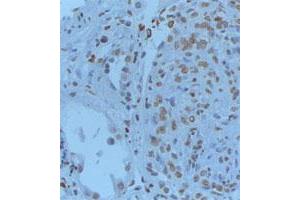 Formalin-PBS and Bouin embedded paraffin human renal tissue pretreated with heat induced epitope retrieval Citrate buffer pH 6. (GREM1 antibody  (C-Term))