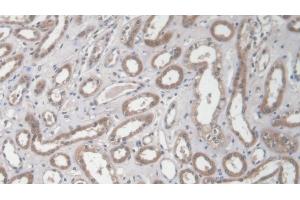 Detection of COL1a2 in Human Kidney Tissue using Polyclonal Antibody to Collagen Type I Alpha 2 (COL1a2) (COL1A2 antibody  (AA 1103-1366))