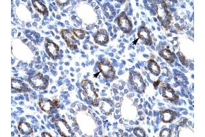 RGS6 antibody was used for immunohistochemistry at a concentration of 4-8 ug/ml to stain Epithelial cells of renal tubule (arrows) in Human Kidney. (RGS6 antibody  (C-Term))