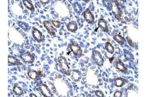 RGS6 antibody was used for immunohistochemistry at a concentration of 4-8 ug/ml to stain Epithelial cells of renal tubule (arrows) in Human Kidney.