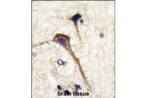 Formalin-fixed and paraffin-embedded human brain tissue reacted with INA antibody (Center) (ABIN390240 and ABIN2840709) , which was peroxidase-conjugated to the secondary antibody, followed by DAB staining. (INA antibody  (AA 290-319))