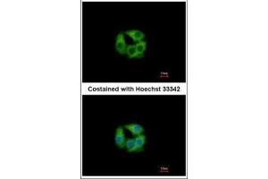 ICC/IF Image Immunofluorescence analysis of methanol-fixed Hep G2, using PCCB, antibody at 1:500 dilution. (PCCB antibody  (Center))