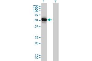 Western Blot analysis of GPT expression in transfected 293T cell line by GPT monoclonal antibody (M03), clone 4E2. (ALT antibody  (AA 1-496))