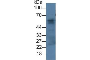 Detection of FBLN3 in Rat Skin lysate using Monoclonal Antibody to Fibulin 3 (FBLN3) (FBLN3 antibody  (AA 26-213))