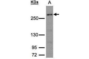 WB Image Sample (30μg whole cell lysate) A:293T whole cell lysate 5% SDS PAGE antibody diluted at 1:1500 (CAD antibody  (C-Term))