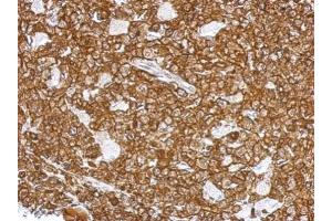 IHC-P Image Immunohistochemical analysis of paraffin-embedded RF48 xenograft, using L-Plastin, antibody at 1:500 dilution. (LCP1 antibody)
