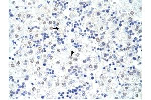 HNRPL antibody was used for immunohistochemistry at a concentration of 4-8 ug/ml to stain Hepatocytes (arrows) in Human Liver. (HNRNPL antibody  (N-Term))
