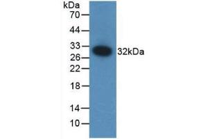 Western blot analysis of recombinant Mouse F12. (F12 antibody  (AA 352-587))