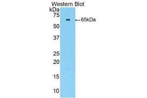 Western Blotting (WB) image for anti-Fast Skeletal Troponin C (TNNC2) (AA 2-160) antibody (ABIN1860813) (TNNC2 antibody  (AA 2-160))
