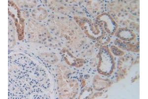 Figure. (MAPKAP Kinase 2 antibody  (AA 139-367))