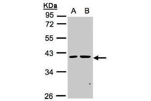 WB Image Sample(30 ug whole cell lysate) A:MOLT4 , B:Raji , 10% SDS PAGE antibody diluted at 1:1000 (PSKH2 antibody)