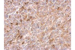 IHC-P Image Urokinase antibody detects PLAU protein at cytosol on H1299 xenograft by immunohistochemical analysis. (PLAU antibody)