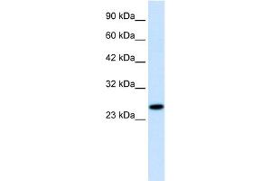 WB Suggested Anti-RGS13 Antibody Titration:  1. (RGS13 antibody  (Middle Region))