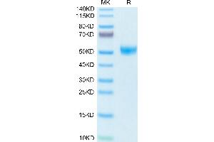 Mouse TIGIT on Tris-Bis PAGE under reduced condition. (TIGIT Protein (AA 26-143) (Fc Tag))