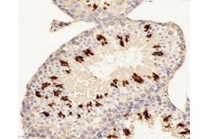 Immunohistochemistry analysis of paraffin-embedded mouse testis using,H2ab1 (ABIN7074228) at dilution of 1: 8800 (H2-AB1 antibody)