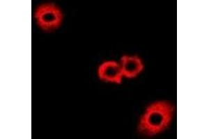Immunofluorescent analysis of Fumarylacetoacetase staining in A549 cells. (FAH antibody)