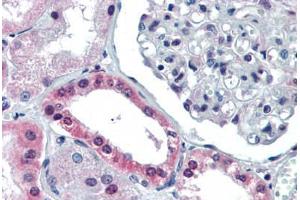 Human Kidney (formalin-fixed, paraffin-embedded) stained with PAX4 antibody ABIN462174 followed by biotinylated goat anti-rabbit IgG secondary antibody ABIN481713, alkaline phosphatase-streptavidin and chromogen. (PAX4 antibody  (AA 166-215))