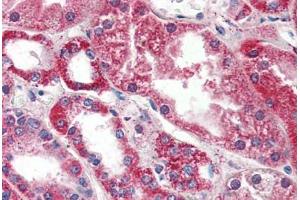 Human Kidney (formalin-fixed, paraffin-embedded) stained with PSPH antibody ABIN364329 at 10 ug/ml followed by biotinylated anti-mouse IgG secondary antibody ABIN481714, alkaline phosphatase-streptavidin and chromogen. (PSPH antibody  (AA 1-225))