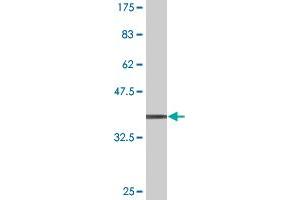 Western Blot detection against Immunogen (37.