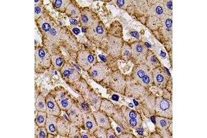 Immunohistochemical analysis of HLA-A staining in mouse liver formalin fixed paraffin embedded tissue section. (HLA-A antibody)